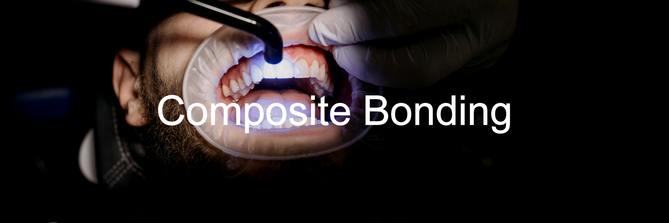 Composite-Bonding-Slider-Image2
