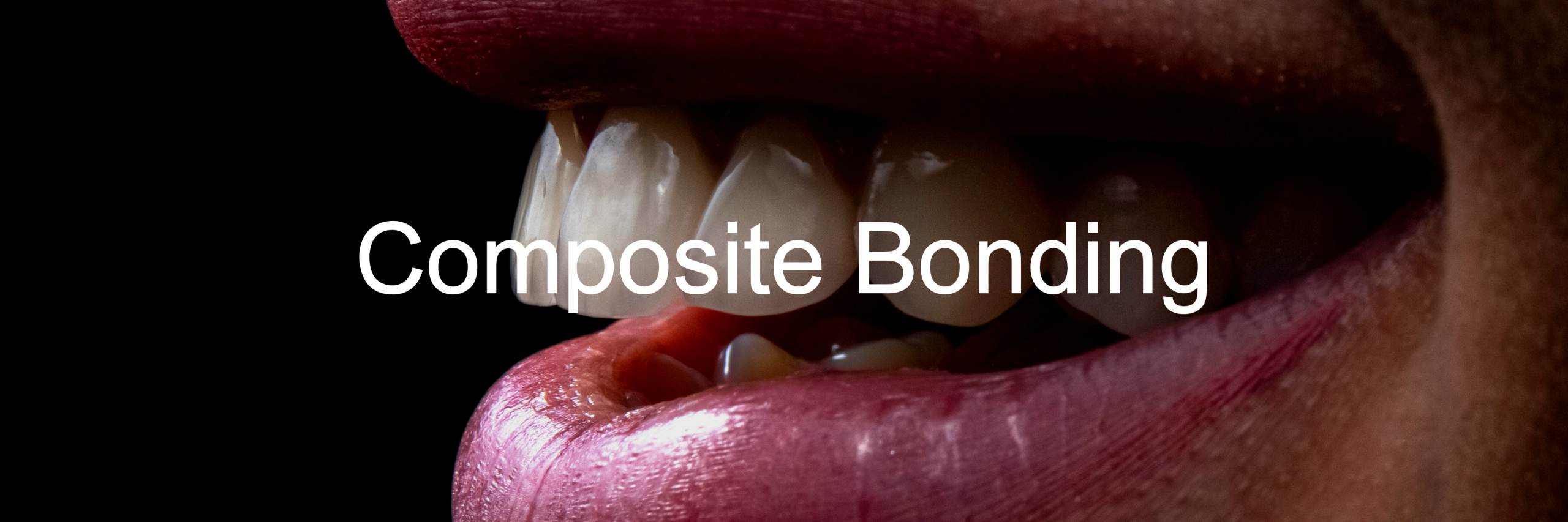 Composite-Bonding-Slider-Image3