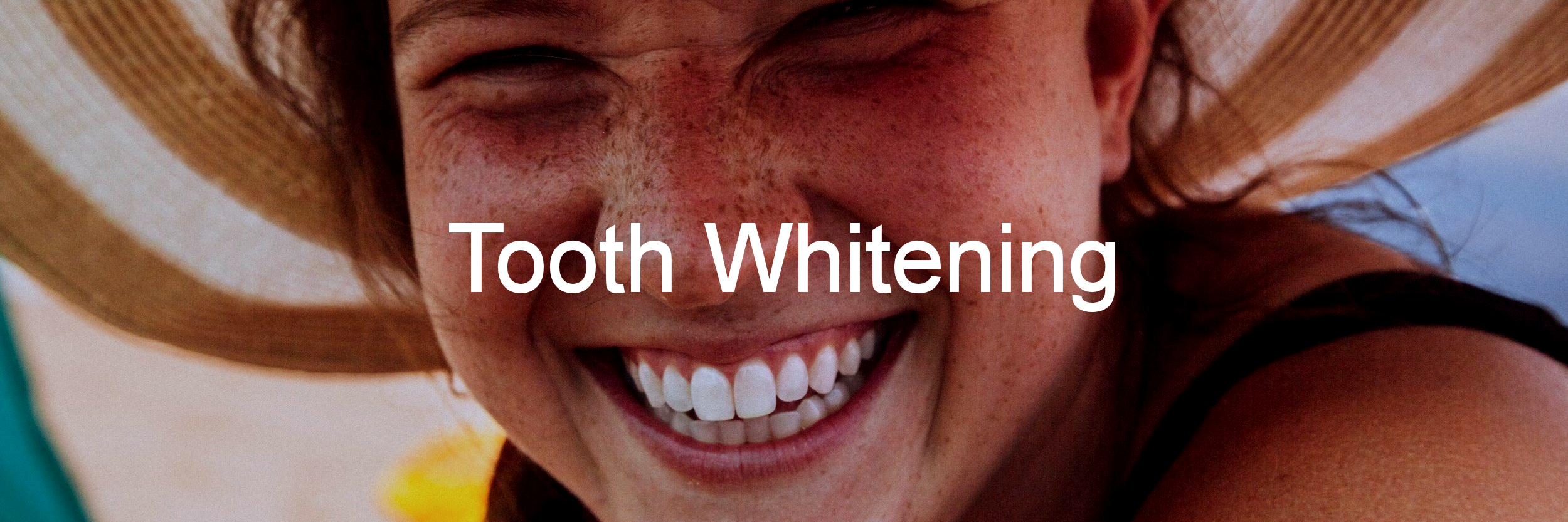 Tooth-Whitening-Slider-Image1